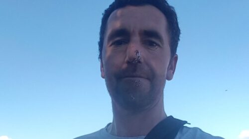 Tim-Hall-blog-image-after-accident-2022_